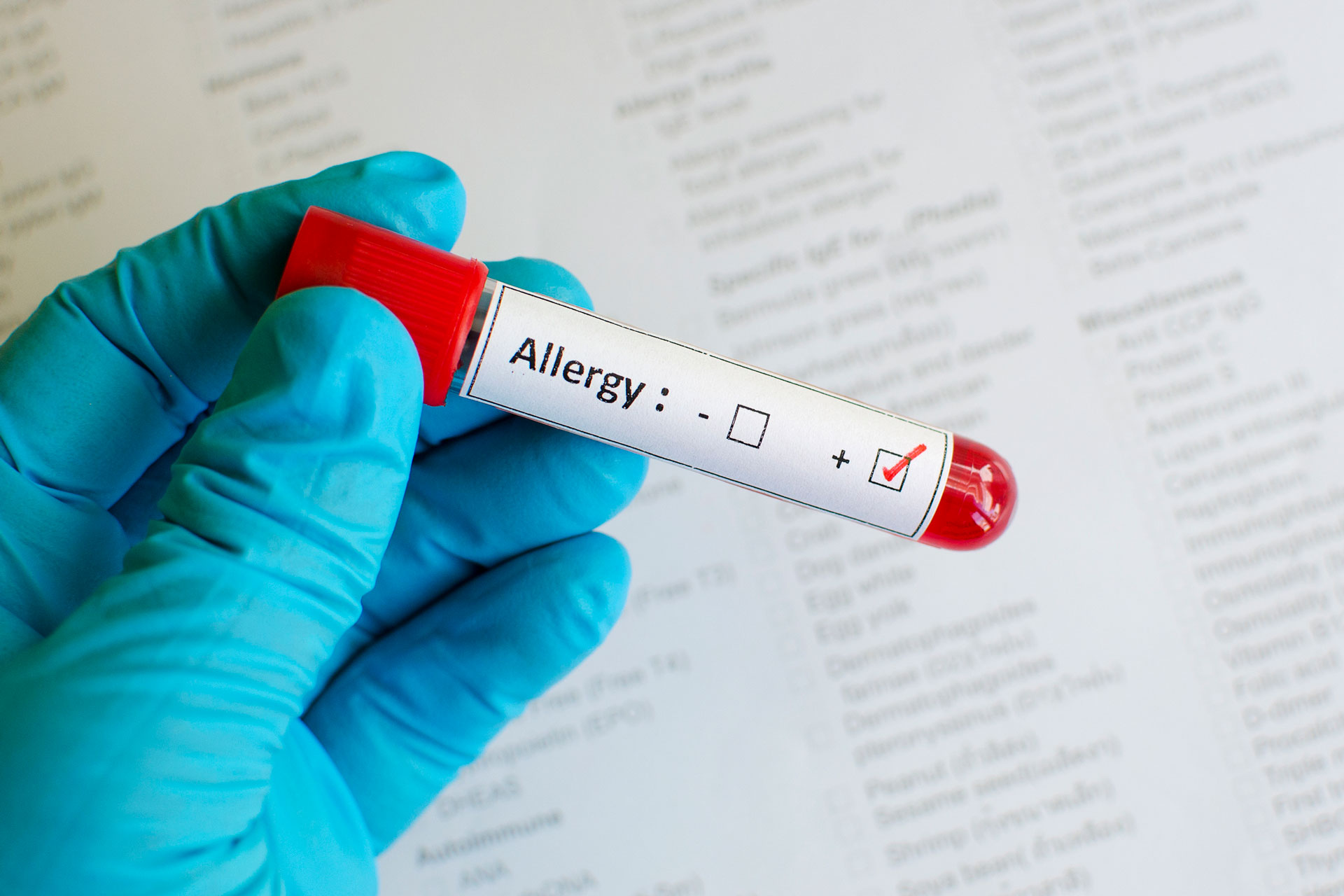 Allergy Blood Testing Near Me