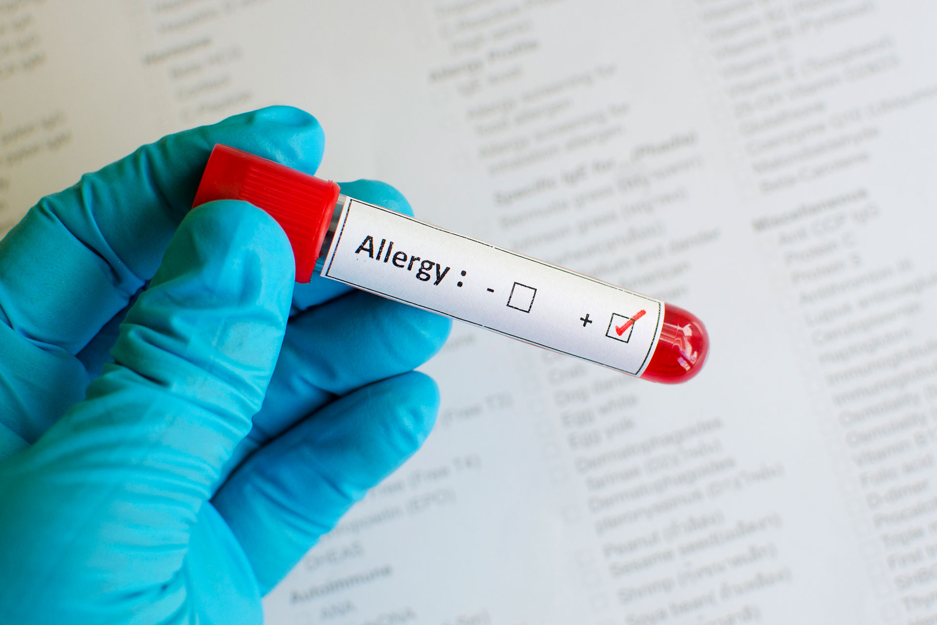 Allergy Blood Test Vs Skin Test