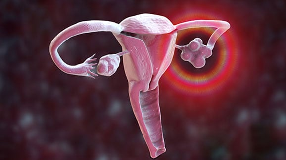 Online Anti Mullerian hormone test