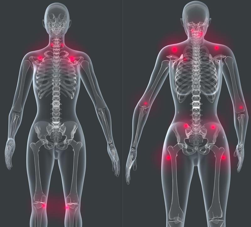 Order lab testing for Fibromyalgia.
