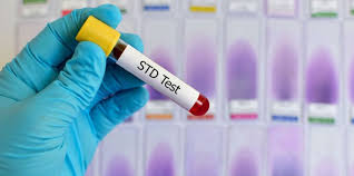 How to get an STD Test