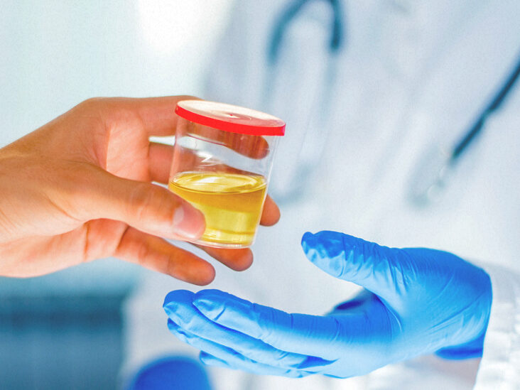 Urine Drug Testing, Order an online Drug Test